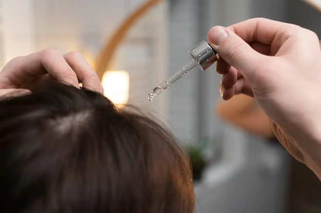 cara menghilangkan ketombe dan rambut rontok