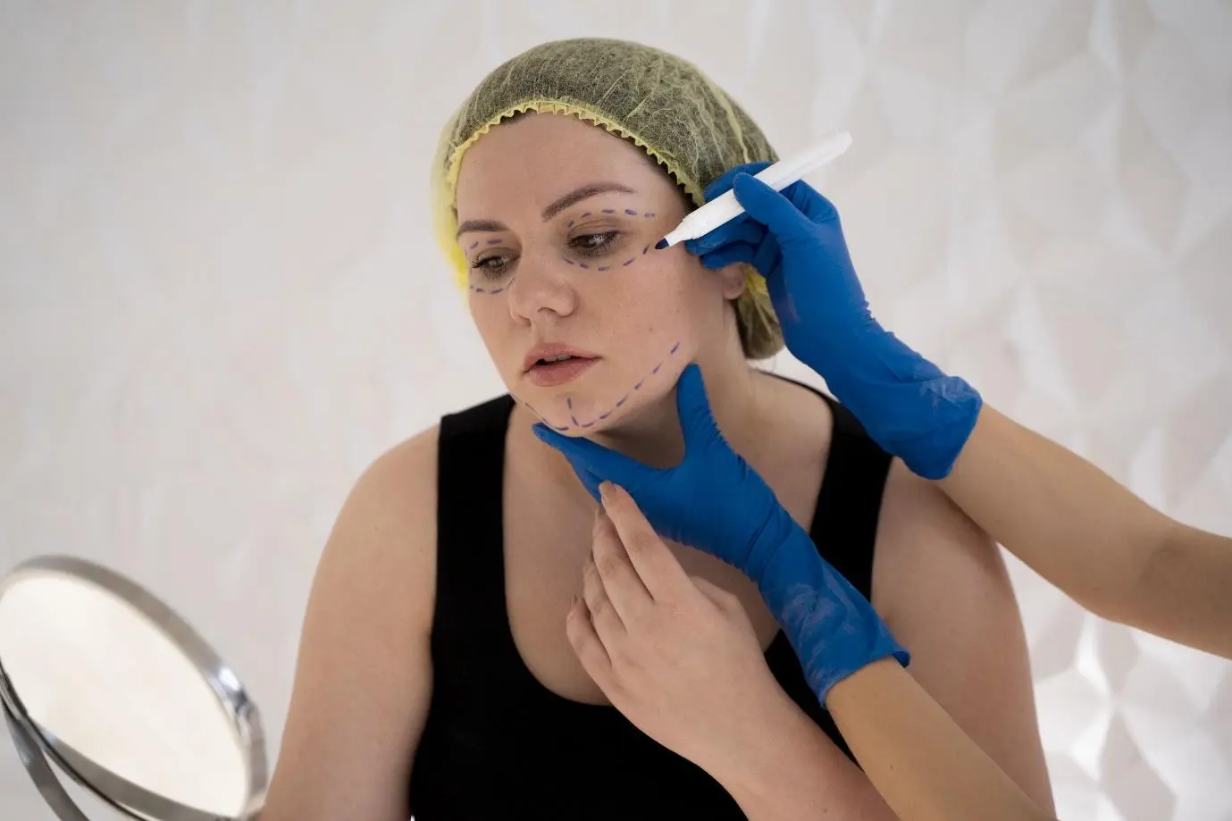 Liposuction Double Chin