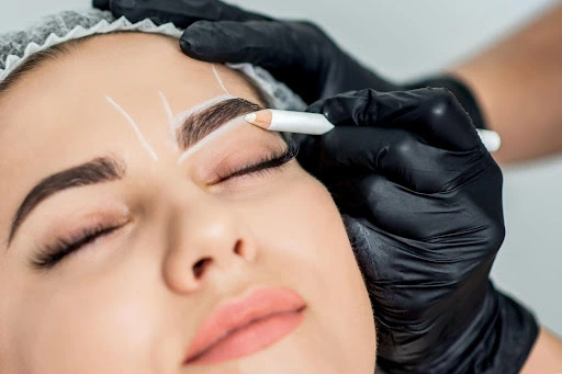 brow lift adalah