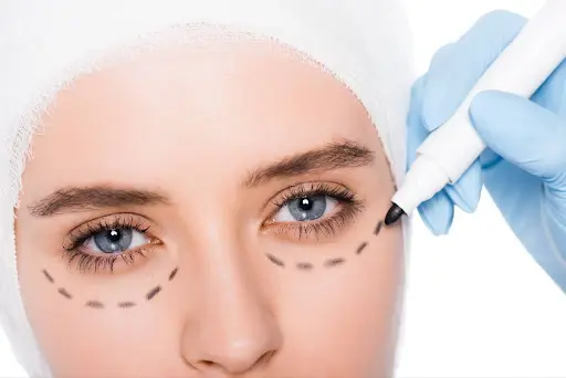 lower blepharoplasty adalah