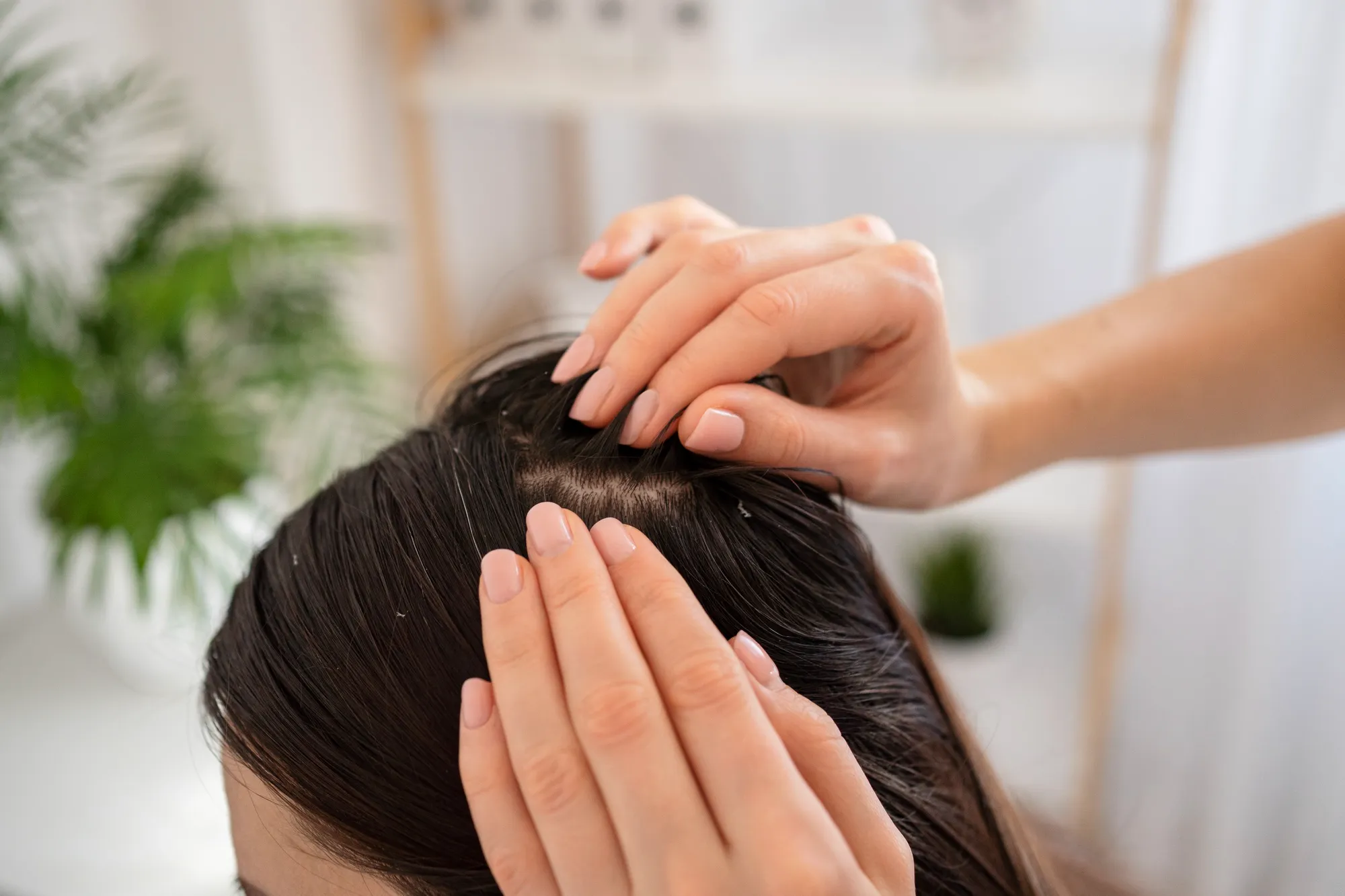 dermatitis-rambut
