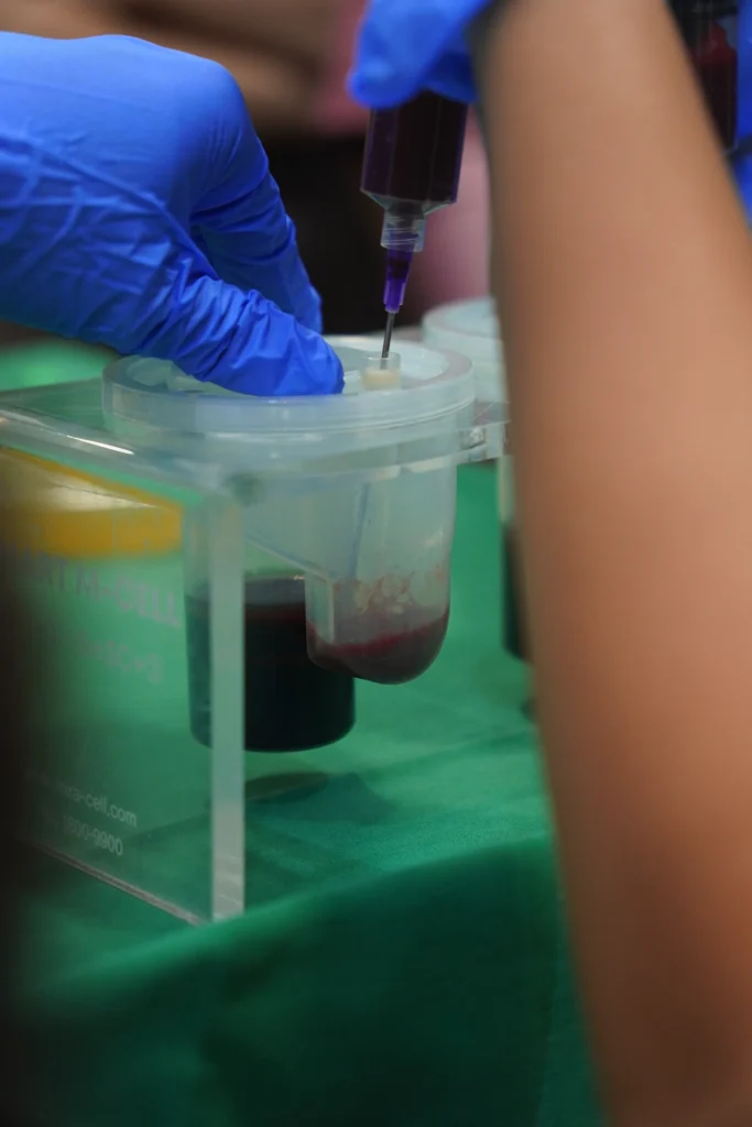 Treatment Stem Cell Plasthetic Clinic