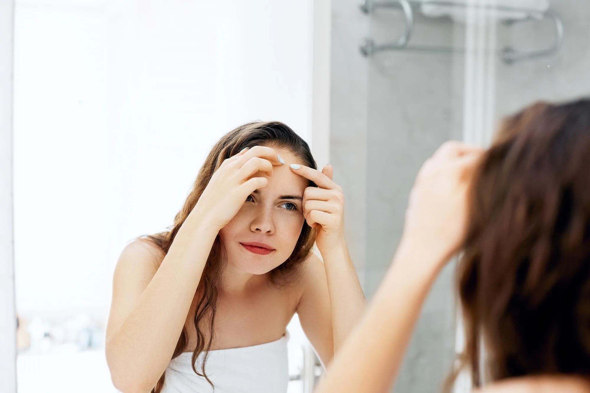 cara mengatasi jerawat hormonal