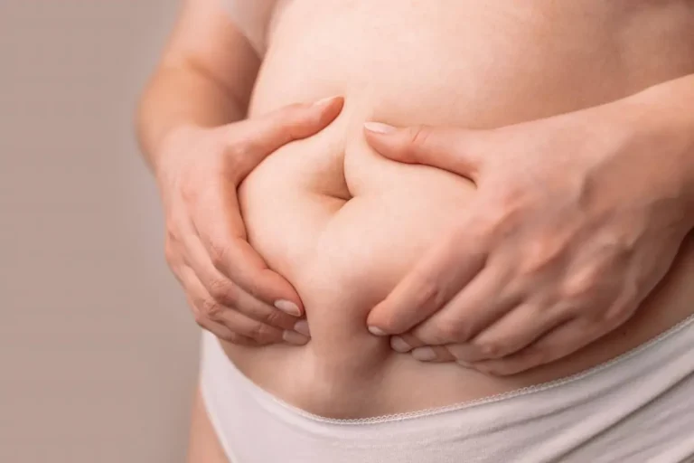 Perbedaan sedot lemak dengan tummy tuck.webp