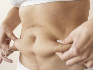 Tummy scaled 1.jpg