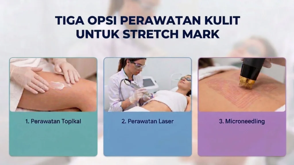 Apakah Stretch Mark pada Remaja Bisa Dihilangkan
