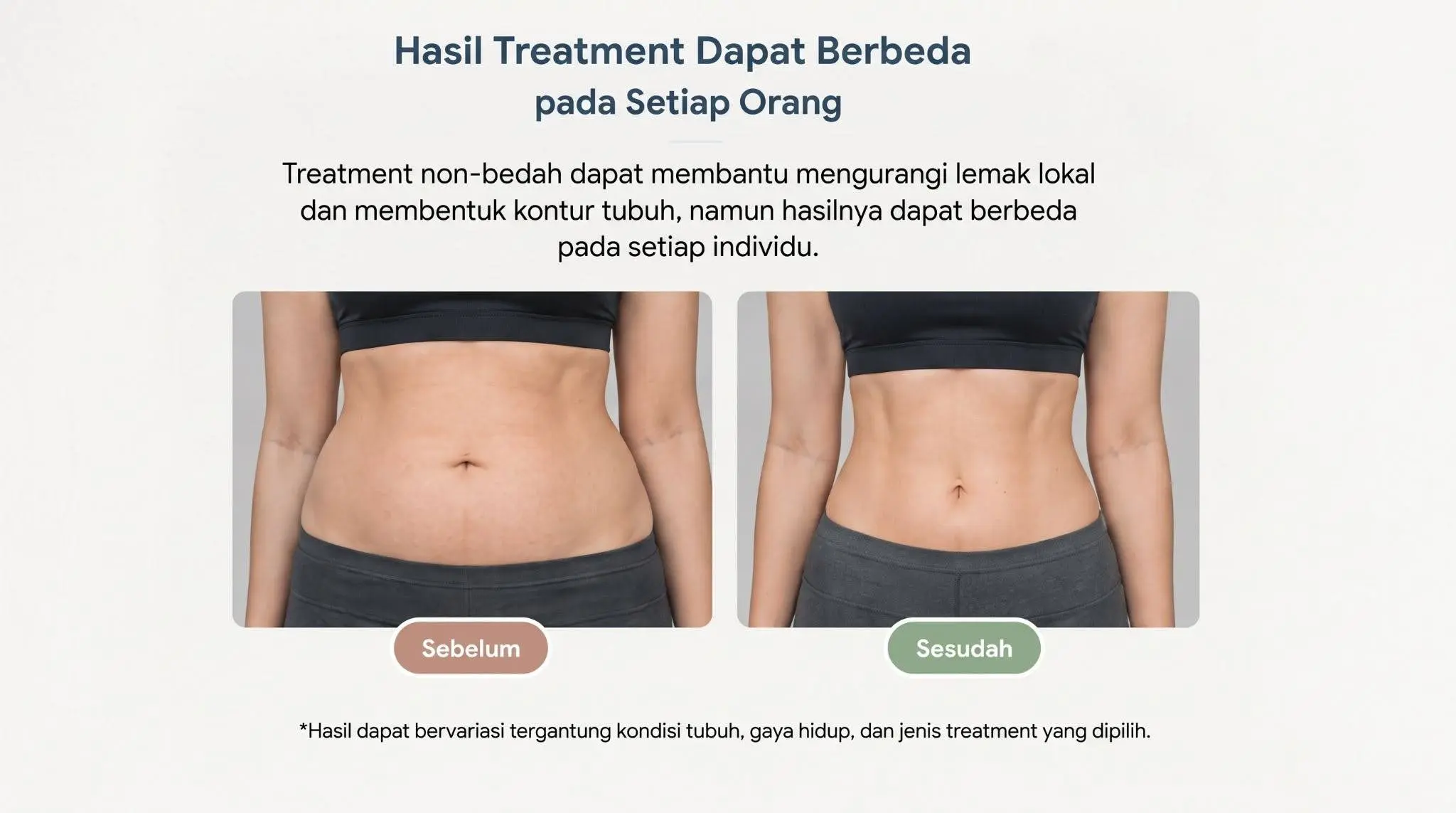 hasil treatment sedot lemak perut